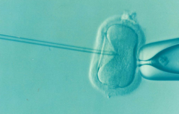 In-vitro-Fertilisation