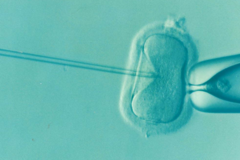 In-vitro-Fertilisation