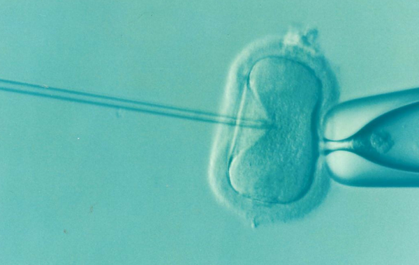In-vitro-Fertilisation