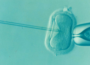 In-vitro-Fertilisation